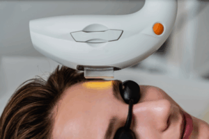 Photofacial Treatment Prices in Lancaster, Pennsylvania
