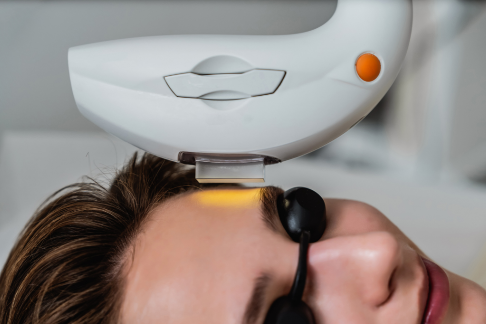 Photofacial Treatment Prices in Lancaster, Pennsylvania
