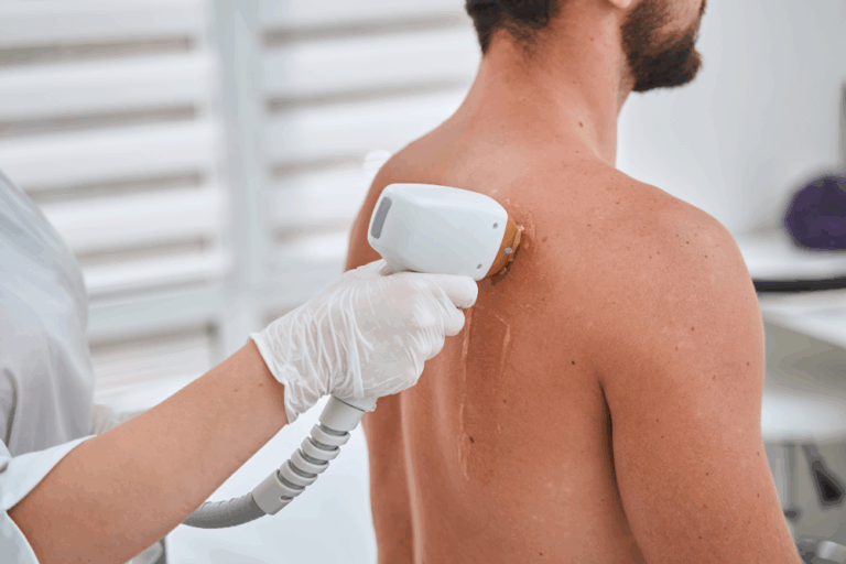 Men’s Back and Shoulder Laser Hair Removal Prices Near Elizabethtown, Pennsylvania