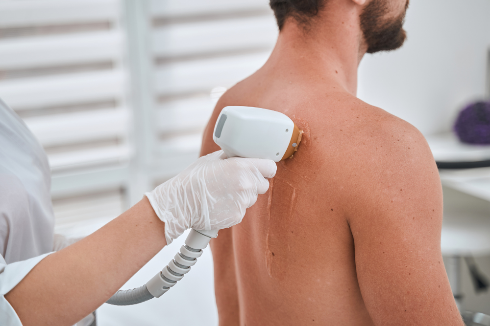 Men’s Back and Shoulder Laser Hair Removal Prices Near Elizabethtown, Pennsylvania