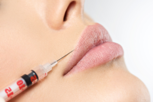 Mini Lip Filler Options Near Lancaster, Pennsylvania for Natural Volume