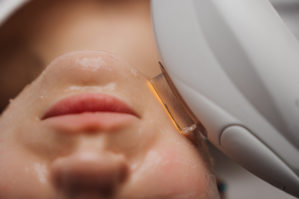 IPL Skin Rejuvenation in Leola, Pennsylvania for Redness and Rosacea