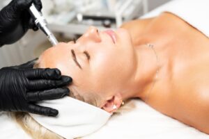 Microneedling with PRP Options in Lancaster, Pennsylvania