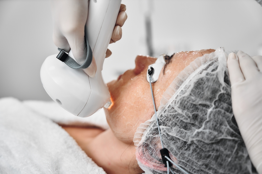 IPL Treatments in Lititz, Pennsylvania for Brown Spots and Sun Damage