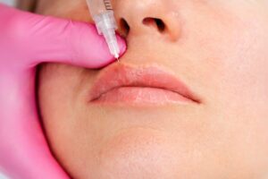 Lip Filler Prices Near East Petersburg, Pennsylvania: How Much Does 1 Syringe Cost?
