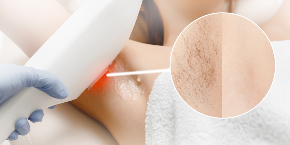 Tired of Shaving? Try Laser Hair Removal in Lancaster, Pennsylvania
