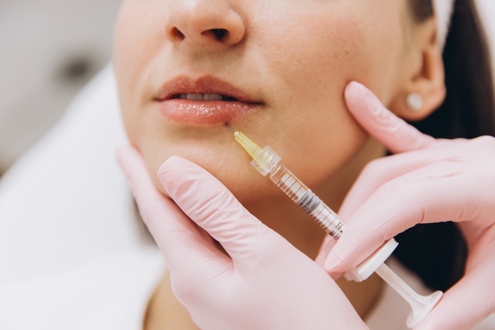 Lip Filler Cost in York, Pennsylvania: What Impacts Price, Results, and Longevity? 