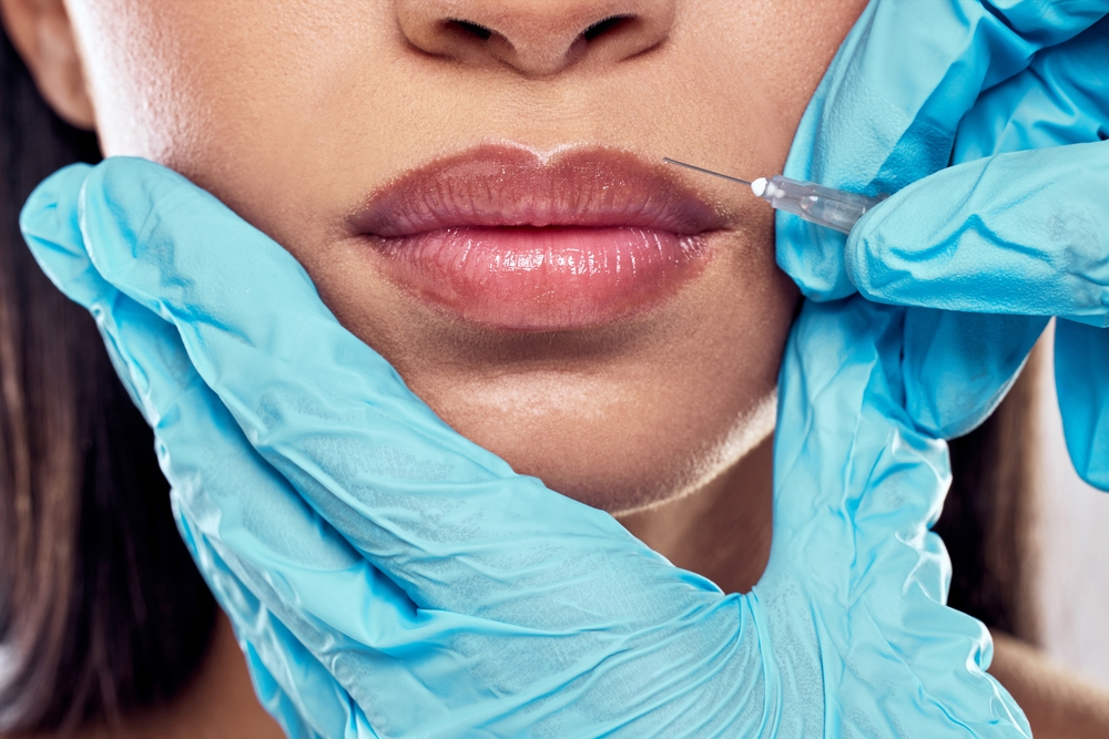 Botox and Lip Filler Packages in Lancaster, Pennsylvania for Full Facial Refresh