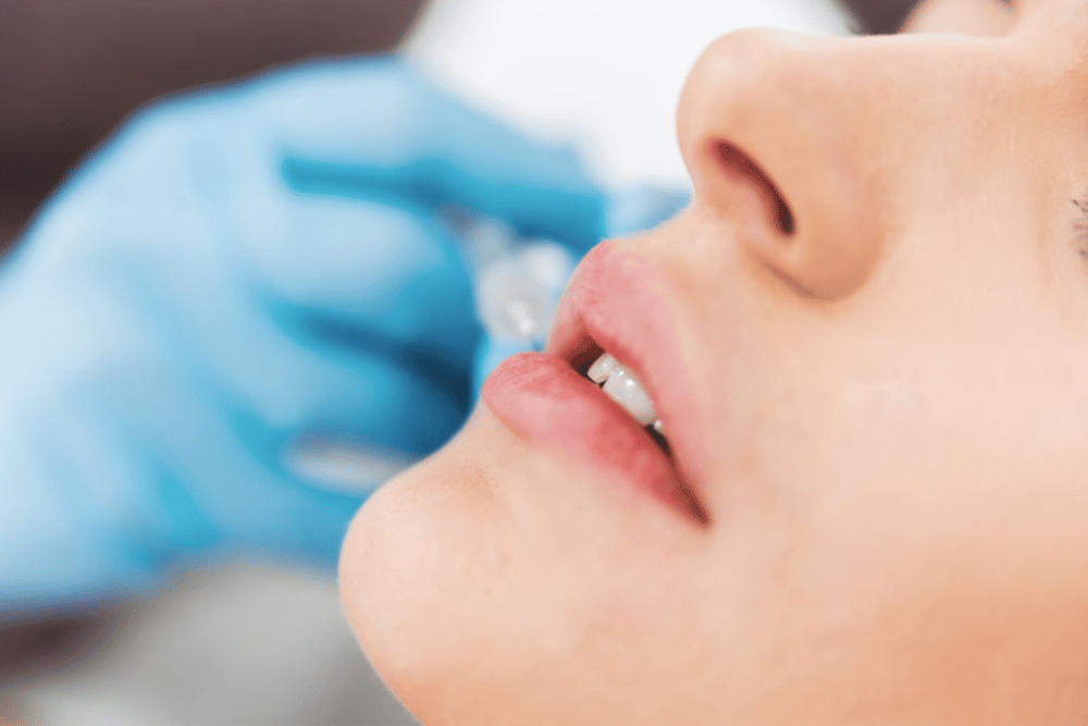 Best Lip Filler Treatments Near East Petersburg PA