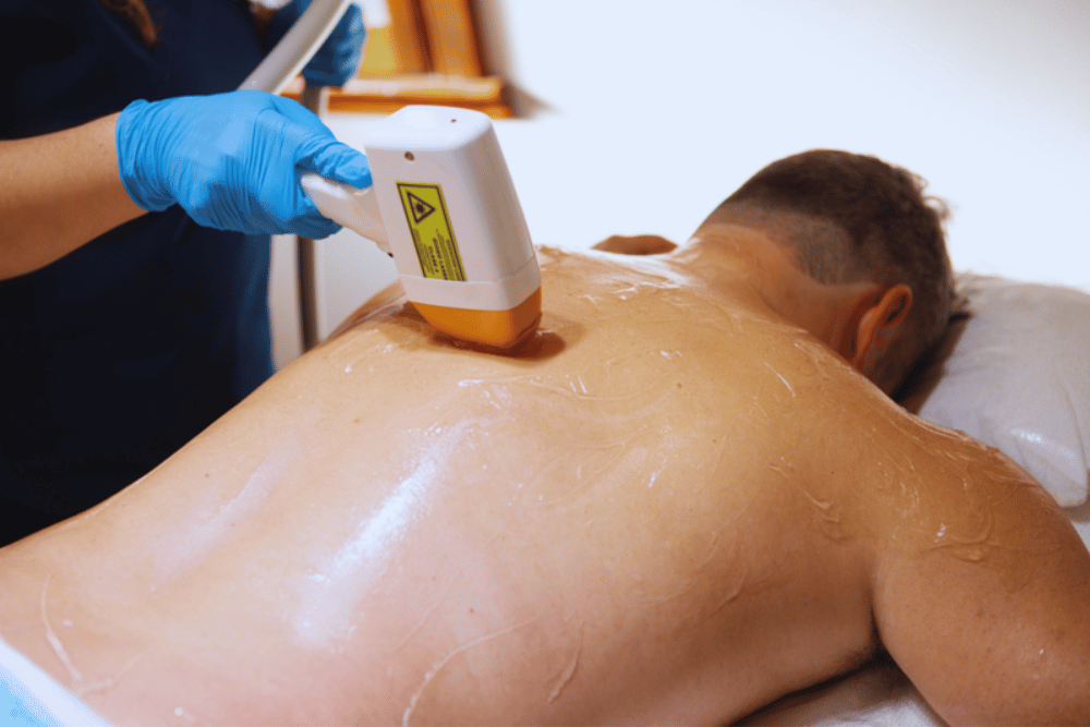 Laser Hair Removal for Men Near Denver PA
